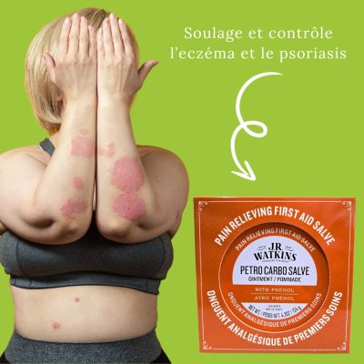 Onguent petro-carbo soulage eczéma psoriasis